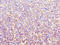 Actin Related Protein 3B antibody, LS-C379781, Lifespan Biosciences, Immunohistochemistry paraffin image 