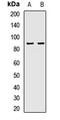 Endothelin Converting Enzyme 1 antibody, LS-C667782, Lifespan Biosciences, Western Blot image 