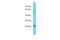 Transmembrane Protein 182 antibody, A15303, Boster Biological Technology, Western Blot image 