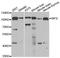 Melanotransferrin antibody, LS-C334851, Lifespan Biosciences, Western Blot image 