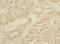 Mitogen-Activated Protein Kinase Kinase Kinase Kinase 3 antibody, LS-C676015, Lifespan Biosciences, Immunohistochemistry paraffin image 