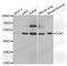 Docking Protein 1 antibody, A5687, ABclonal Technology, Western Blot image 