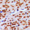 G Protein Regulated Inducer Of Neurite Outgrowth 2 antibody, LS-C353187, Lifespan Biosciences, Immunohistochemistry paraffin image 