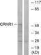 Corticotropin Releasing Hormone Receptor 1 antibody, LS-C120567, Lifespan Biosciences, Western Blot image 