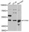 Protein Tyrosine Phosphatase Receptor Type R antibody, LS-C747396, Lifespan Biosciences, Western Blot image 