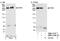 Inositol 1,4,5-Trisphosphate Receptor Type 1 antibody, NBP1-21398, Novus Biologicals, Western Blot image 