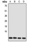 Translocase Of Inner Mitochondrial Membrane 8A antibody, LS-C668687, Lifespan Biosciences, Western Blot image 