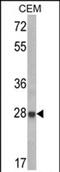 Insulin Like Growth Factor Binding Protein 6 antibody, PA5-72464, Invitrogen Antibodies, Western Blot image 