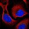 Ubiquitin Interaction Motif Containing 1 antibody, HPA037503, Atlas Antibodies, Immunofluorescence image 