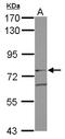 GIT ArfGAP 2 antibody, LS-B10868, Lifespan Biosciences, Western Blot image 