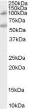 Nucleotide Binding Oligomerization Domain Containing 2 antibody, PA5-18572, Invitrogen Antibodies, Western Blot image 