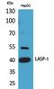 LIM And SH3 Protein 1 antibody, PA5-51092, Invitrogen Antibodies, Western Blot image 