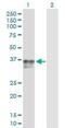 Insulin Like Growth Factor Binding Protein 3 antibody, H00003486-D01P, Novus Biologicals, Western Blot image 