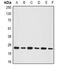 BCL2 Interacting Protein 1 antibody, abx225067, Abbexa, Western Blot image 