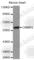 Dihydropyrimidinase Like 3 antibody, A2877, ABclonal Technology, Western Blot image 