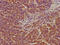 Leucyl-TRNA Synthetase antibody, CSB-PA873736LA01HU, Cusabio, Immunohistochemistry paraffin image 
