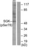 Serum/Glucocorticoid Regulated Kinase 1 antibody, LS-C199564, Lifespan Biosciences, Western Blot image 