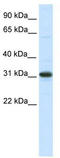 Nuclear Receptor Interacting Protein 2 antibody, TA342347, Origene, Western Blot image 