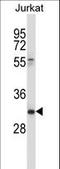 CD7 Molecule antibody, LS-C168558, Lifespan Biosciences, Western Blot image 