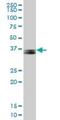 Parvin Gamma antibody, H00064098-B01P, Novus Biologicals, Western Blot image 