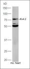 Potassium Voltage-Gated Channel Subfamily D Member 2 antibody, orb1336, Biorbyt, Western Blot image 