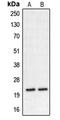 Calcineurin Like EF-Hand Protein 2 antibody, LS-B13275, Lifespan Biosciences, Western Blot image 