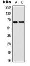 Epsin 2 antibody, LS-B13714, Lifespan Biosciences, Western Blot image 