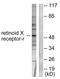 Retinoid X Receptor Gamma antibody, LS-C118569, Lifespan Biosciences, Western Blot image 