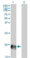 Endothelial Cell Specific Molecule 1 antibody, H00011082-M02, Novus Biologicals, Western Blot image 