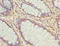 Acidic Residue Methyltransferase 1 antibody, orb37004, Biorbyt, Immunohistochemistry paraffin image 