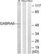 Gamma-Aminobutyric Acid Type A Receptor Alpha6 Subunit antibody, LS-C119988, Lifespan Biosciences, Western Blot image 