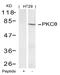 Protein Kinase C Theta antibody, AP02699PU-N, Origene, Western Blot image 