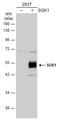 Serum/Glucocorticoid Regulated Kinase 1 antibody, GTX107750, GeneTex, Western Blot image 