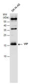 Vasoactive Intestinal Peptide antibody, GTX129997, GeneTex, Western Blot image 