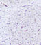 Phosphatidylinositol-3,4,5-trisphosphate 5-phosphatase 2 antibody, LS-C756515, Lifespan Biosciences, Immunohistochemistry frozen image 