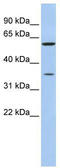 Aldose reductase antibody, TA346555, Origene, Western Blot image 