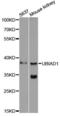 UbiA Prenyltransferase Domain Containing 1 antibody, LS-C748473, Lifespan Biosciences, Western Blot image 