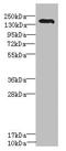 Roundabout Guidance Receptor 2 antibody, LS-C676412, Lifespan Biosciences, Western Blot image 