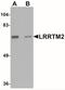 Leucine Rich Repeat Transmembrane Neuronal 2 antibody, NBP2-41129, Novus Biologicals, Western Blot image 