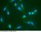 Mitogen-Activated Protein Kinase 9 antibody, 10745-R011, Sino Biological, Immunohistochemistry paraffin image 