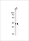 STIP1 Homology And U-Box Containing Protein 1 antibody, PA5-35110, Invitrogen Antibodies, Western Blot image 