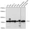 Tousled Like Kinase 1 antibody, GTX66297, GeneTex, Western Blot image 