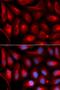 Proteasome Subunit Alpha 5 antibody, orb178619, Biorbyt, Immunofluorescence image 