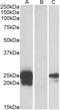 WAP Four-Disulfide Core Domain 2 antibody, LS-C112980, Lifespan Biosciences, Western Blot image 