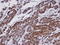 Oxysterol Binding Protein Like 1A antibody, LS-C185905, Lifespan Biosciences, Immunohistochemistry paraffin image 