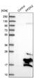 Prefoldin Subunit 2 antibody, NBP1-86378, Novus Biologicals, Western Blot image 