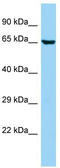 Ankyrin Repeat And Sterile Alpha Motif Domain Containing 1B antibody, TA337731, Origene, Western Blot image 