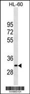 Endometase antibody, 60-765, ProSci, Western Blot image 