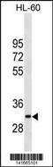 Matrix Metallopeptidase 26 antibody, 60-765, ProSci, Western Blot image 