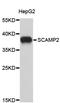 Secretory Carrier Membrane Protein 2 antibody, STJ26638, St John